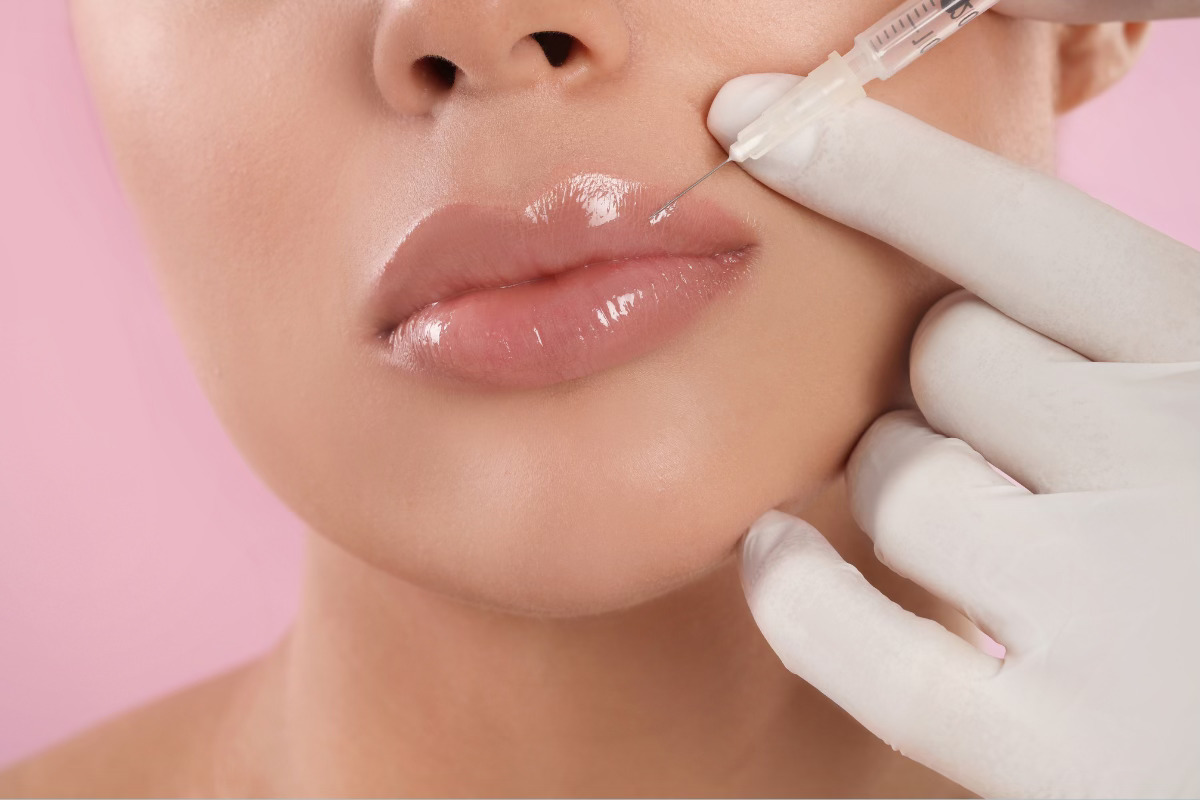 Dermal Fillers